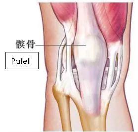 女孩天生髌骨脱位，髌骨脱位遗传吗?