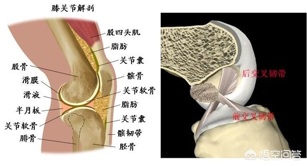 女孩天生髌骨脱位，髌骨脱位遗传吗?