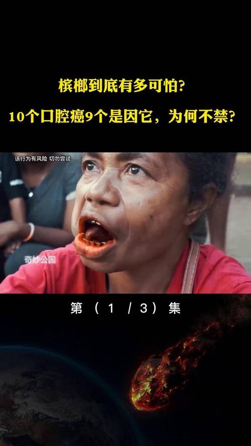 嚼槟榔20年患口腔癌,嚼槟榔20年患口腔癌几率大吗