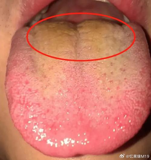 今晚澳门9点35分开奖实用性解读和舌根和牙龈被缝一起与舌根和牙龈被缝一起怎么办